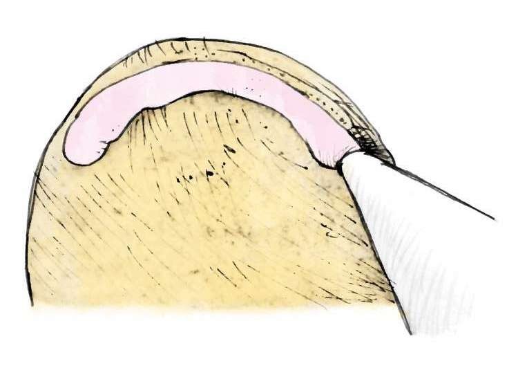 Illustration of dam being piped into cake